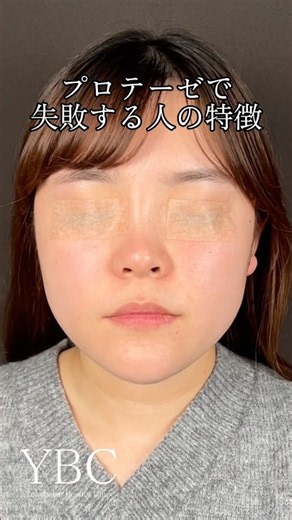 プロテーゼで失敗する人の特徴…#ybc横浜美容外科 #鼻整形