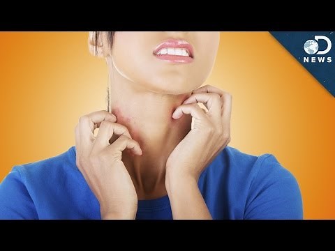 Why Scratching An Itch Makes It Worse
