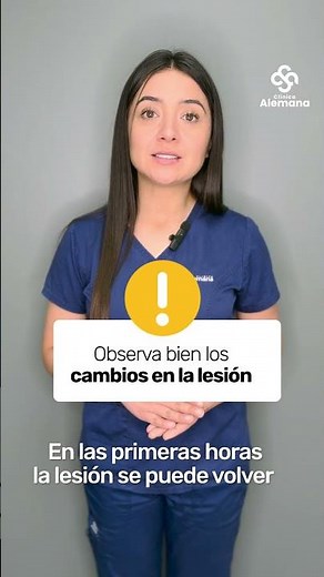 ¿Qué hacer si te pica una araña de rincón? | Clínica Alemana