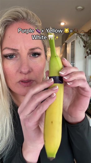 Teeth Whitening Strips: A Shocking Transformation!