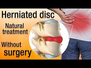 How to heal a herniated disc naturally? Treatment and recovery