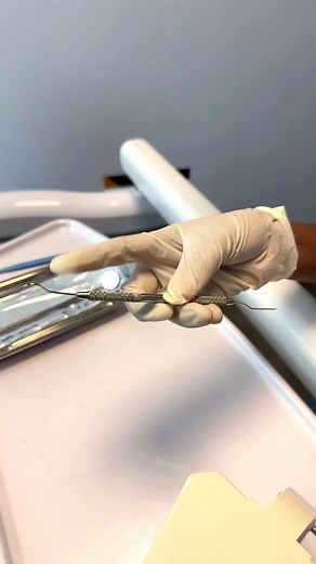 Curious about those dental probes you see during your check-ups? Check out our quick guide to learn more about these essential tools and how they keep your smile in check! #DentalProbes #DentistTools #SriLankaDentist #DentalCare #MyDentist