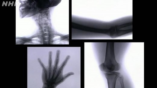 人の体が動くのは？ | NHK for School