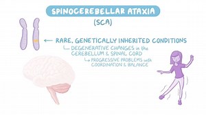 Video: Spinocerebellar ataxia (NORD) - Video Explanation! | Osmosis | Osmosis