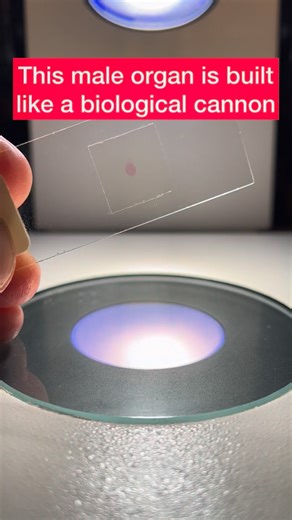 Adolfo Sánchez-Blanco, PhD🇪🇸🇺🇸 on Instagram: "Biologically speaking, the vas deferens is a powerful muscular tube designed for one primary purpose: the forceful propulsion of sperm cells in the direction of the urethra. . To work as a biological cannon that moves sperm forward quickly, the vas deferens is equipped with a massive muscularis layer composed of 3 layers of smooth muscle (an inner longitudinal layer, a middle circular layer, and an outer longitudinal layer). The coordinated contr