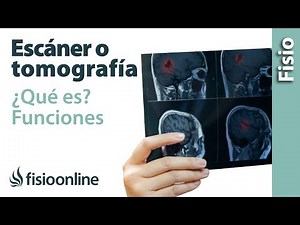 Escáner o tomografía - ¿Qué es y cómo funciona?