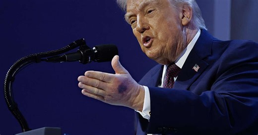 Trump volta a chamar atenção por hematoma na mão durante aparição em Davos
