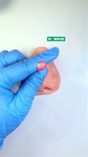 给鼻子做个spa吧 回复 @@闪闪发光的紫霞的评论 #解压#解压视频#解压玩具#挤痘痘解压 #解压视频