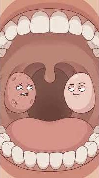 Why Your Breath Smells Even Though You Brush - Tonsil Stones and Removing a Tonsil Stone