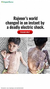 531 reactions · 88 shares | My son Rajveer, just 8 years old, is in constant pain from serious burns. He dreams of returning to school but only surgery can heal him. Please help us give him a chance at a bright future! https://tinyurl.com/yc4zjzzj | Impact Guru | Facebook