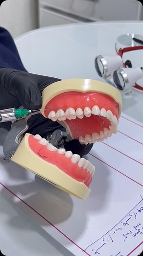 Noor Al-rawi on Instagram: "PSA nerve block"