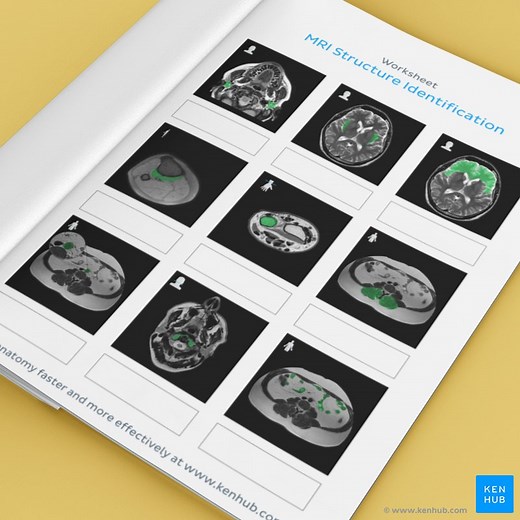 MRI study guide: Test questions and quizzes for review