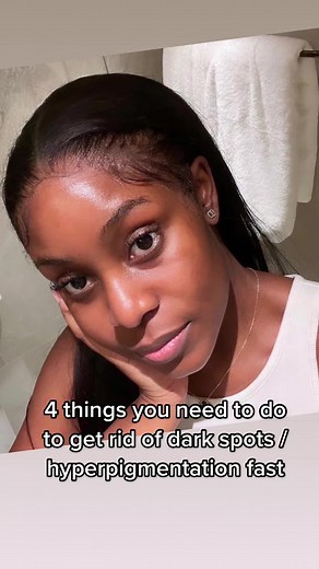 Get Rid of Hyperpigmentation Fast: 4 Key Steps and Product Recommendations