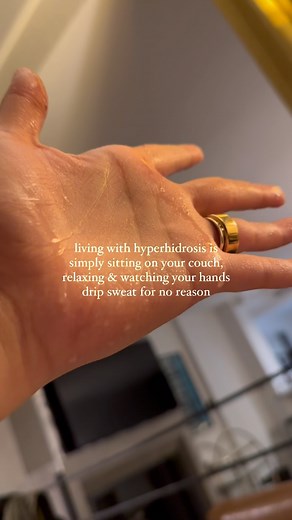 The Center for Hyperhidrosis on Instagram: "We often receive questions about compensatory sweating. The main difference between hyperhidrosis and compensatory sweating is that with Hyperhidrosis, you can simply be sitting on your couch, relaxing, and your hands can sweat for absolutely no reason. In contrast, with compensatory sweating, another area such as your back may sweat more than before, but ONLY when you give yourself a reason to sweat, such as when you’re exercising or when it’s hot out