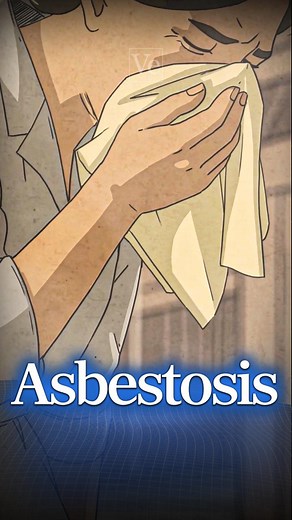 The First Case Of Asbestosis #veritasium #science #physics #asbestos #engineering