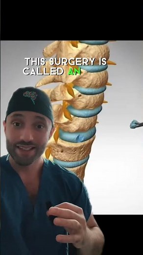 This is an anterior cervical discectomy infusion. Otherwise known as an ACDF.