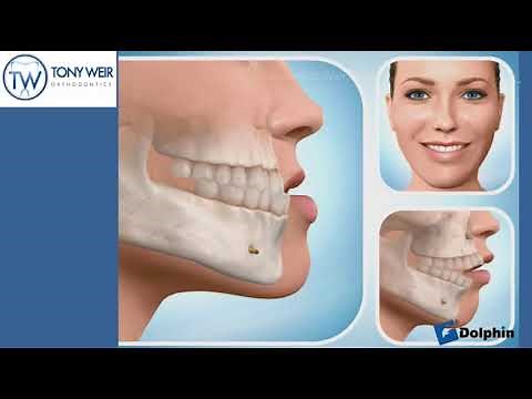Introduction to Orthodontics