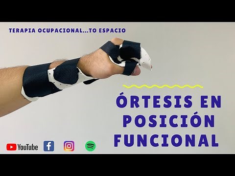 PASO A PASO CÓMO REALIZAR ORTESIS/FÉRULA DE MANO EN POSICIÓN FUNCIONAL