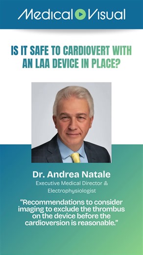 When is cardioversion safe after left atrial appendage closure? Electrophysiologist Dr. Andrea Natale reviews how experienced clinicians approach cardioversion in patients with LAA occlusion devices, focusing on device seating, peri-device leak, and the absence of device-related thrombus. The discussion highlights how real-world decision-making often extends beyond binary guideline thresholds and into careful imaging review and patient-specific context. The full conversation is available on the 
