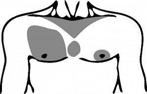 Chest hair - Alchetron, The Free Social Encyclopedia