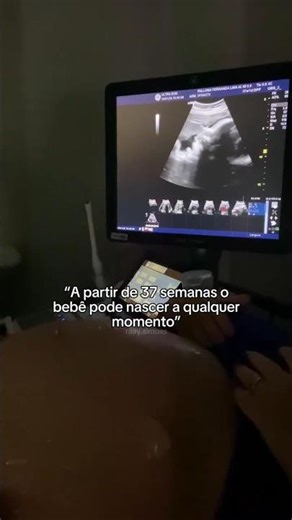 How many weeks pregnant was your baby when he was born?