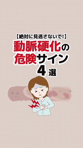 動脈硬化の危険サインを理解しよう
