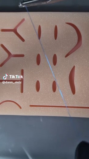 Cómo realizar la sutura en X correctamente