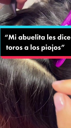 ¿Cómo llamas a los piojos?