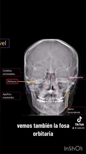 Radiological Anatomy of the Skull in X-ray images - Frontal projection (Cadwell).