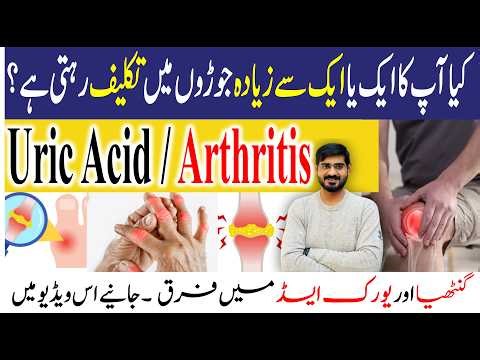 Arthritis vs Uric Acid – Kya Farq Hai? - Ganthia aur Uric Acid Explained - Dr Usman Sohail #uricacid