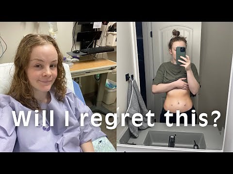 I Got My Tubes Removed as a Childless 28 Year Old