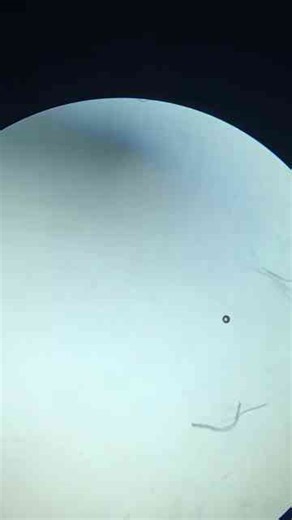 Incredible Microscope Views of Nematodes in Action!