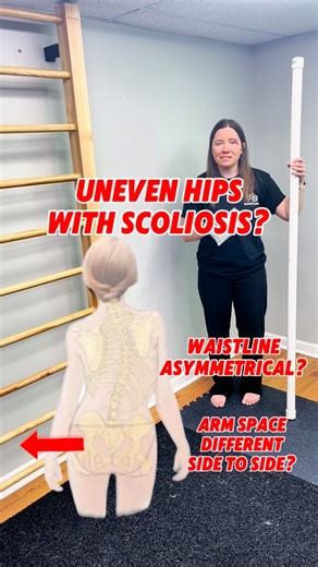 Dr. Katie Blanchard- Scoliosis Exercise | Schroth PT on Instagram: "Do your hips look uneven in photos? Does your waistline curve more on one side? Or maybe there’s more space between your arm and body on one side?📈📉 That could be a hip shift related to your scoliosis curve — and it’s more common than you think. This is where the Statue of Liberty exercise comes in. It helps retrain your body to correct the hip shift and brings you into a more balanced, aligned position. Here’s how it works: S