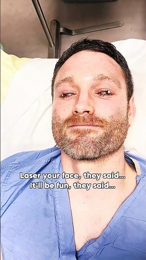 🔥 What Happened to My Face?!🔥 Laser with Ultraclear