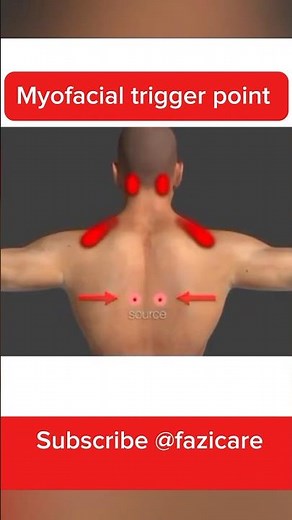 Myofascial Trigger Points | Muscle Knots, Referred Pan