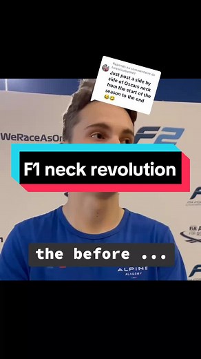F1 Drivers Neck Revolution Explained