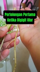 2.7M views · 10K reactions | Pertolongan pertama ketika digigit u l a r #tips #tipsandtricks #tu#tutorial | Idah konawe | Facebook