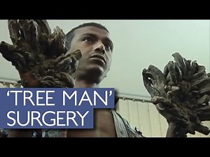 Bangladeshi 'Treeman' Begins Treatment For Bark-Like Warts