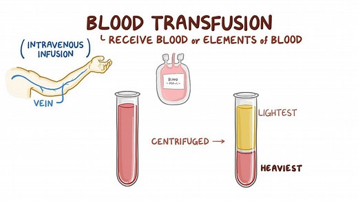 Video: Blood groups and transfusions - Video Explanation! | Osmosis | Osmosis