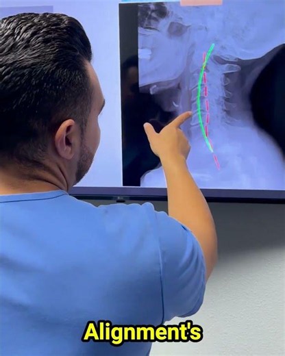 Your neck pain might not stay in your neck🗣️