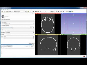 3D Slicer MatlabBridge basics