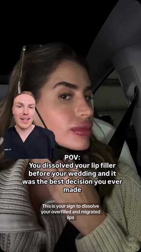 Dr Jonny Betteridge on Instagram: "Lips are one of the most defining features of the face, but when they are overfilled, they can quickly become the only feature people notice. Overfilled lips can disrupt facial harmony, drawing attention away from natural beauty and making the face look unnatural or disproportionate. The goal of aesthetic treatments, including lip fillers, is to enhance your natural features rather than change them drastically. A well-done treatment should blend seamlessly with