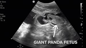 Baby Panda Seen ‘Kicking and Swimming' on Mei Xiang's Ultrasound, National Zoo Says