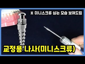 교정과의사가 알려주는 교정용 나사(미니스크류)
