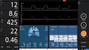 ¿Ya conoces el nuevo simulador de software del respirador Hamilton C6? Permite ajustar la configuración del ventilador y ver los efectos en el modelo del paciente inmediatamente. Si ejecuta la simulación en un dispositivo con una pantalla táctil, el funcionamiento es muy similar al de un dispositivo real. Características del software de simulación: • Una interfaz gráfica de usuario de ventilador completamente simulada con todas las configuraciones de control y alarmas y la mayoría de los modos d