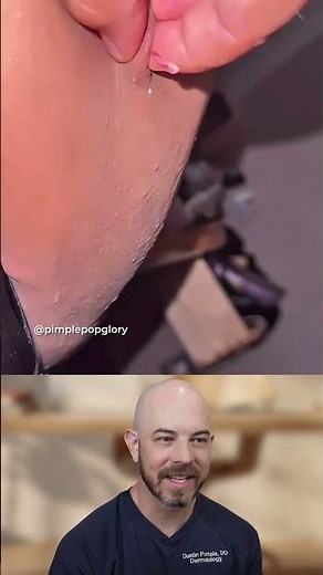 This extraction is explosive