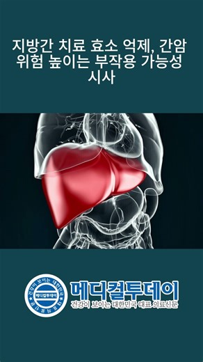 [메디컬투데이 - 쇼츠뉴스] 지방간 치료 효소 억제, 간암 위험 높이는 부작용 가능성 시사