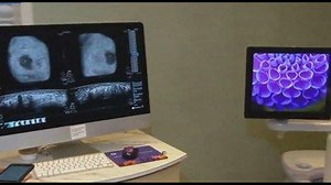 New mammogram machine puts women in control