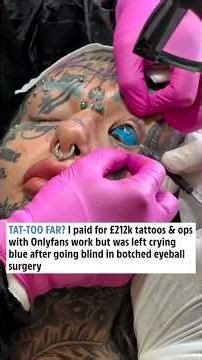 'I went blind after botched eyeball procedure' #tattoo #bodymodification