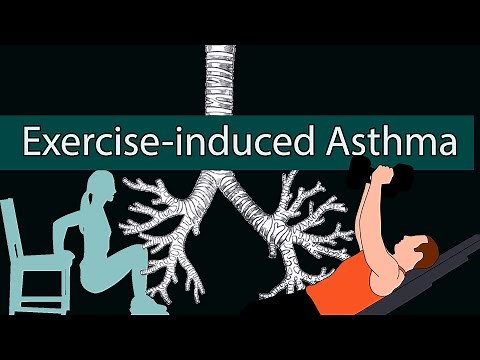 Exercise-induced Asthma - Breathing Discomfort after Exercise